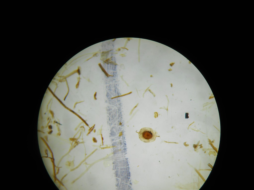Identification help: Freshwater bryozoa statoblast from East Africa