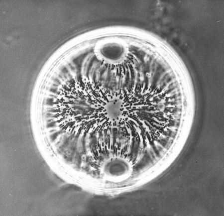 East Winch Borehole, Nar Valley, Norfolk, UK 50 microns http://www.ucl.ac.uk/GeolSci/micropal/diatom.html